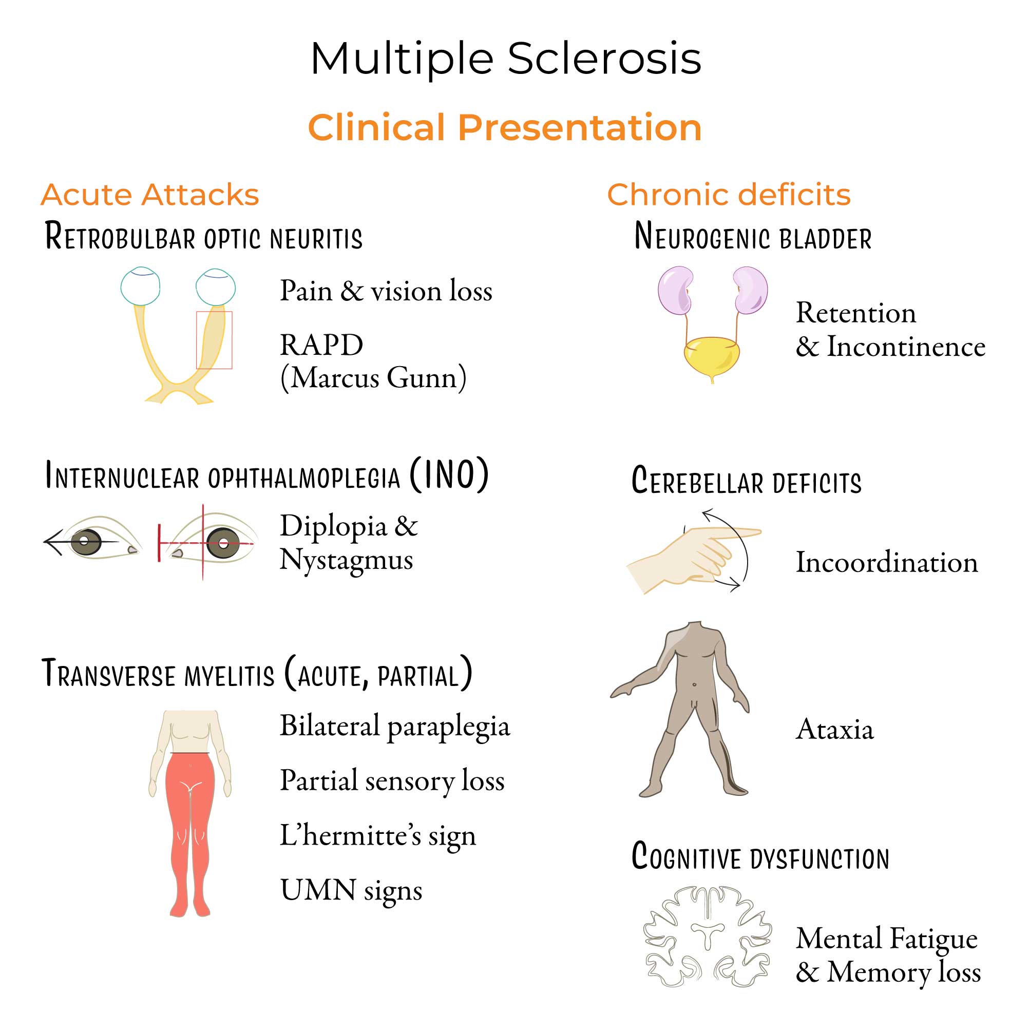 Multiple Sclerosis Multiple Sclerosis