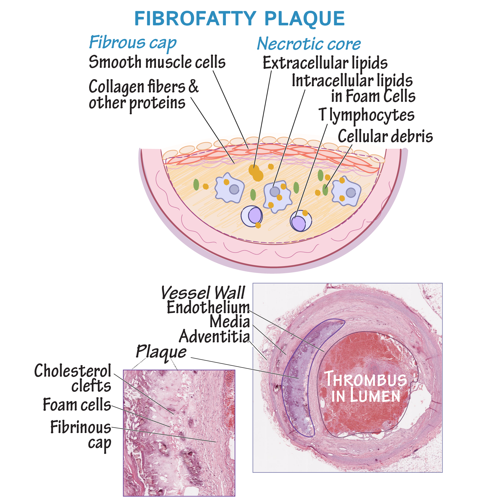 Histology Glossary Histology Uterine Wall Draw It To