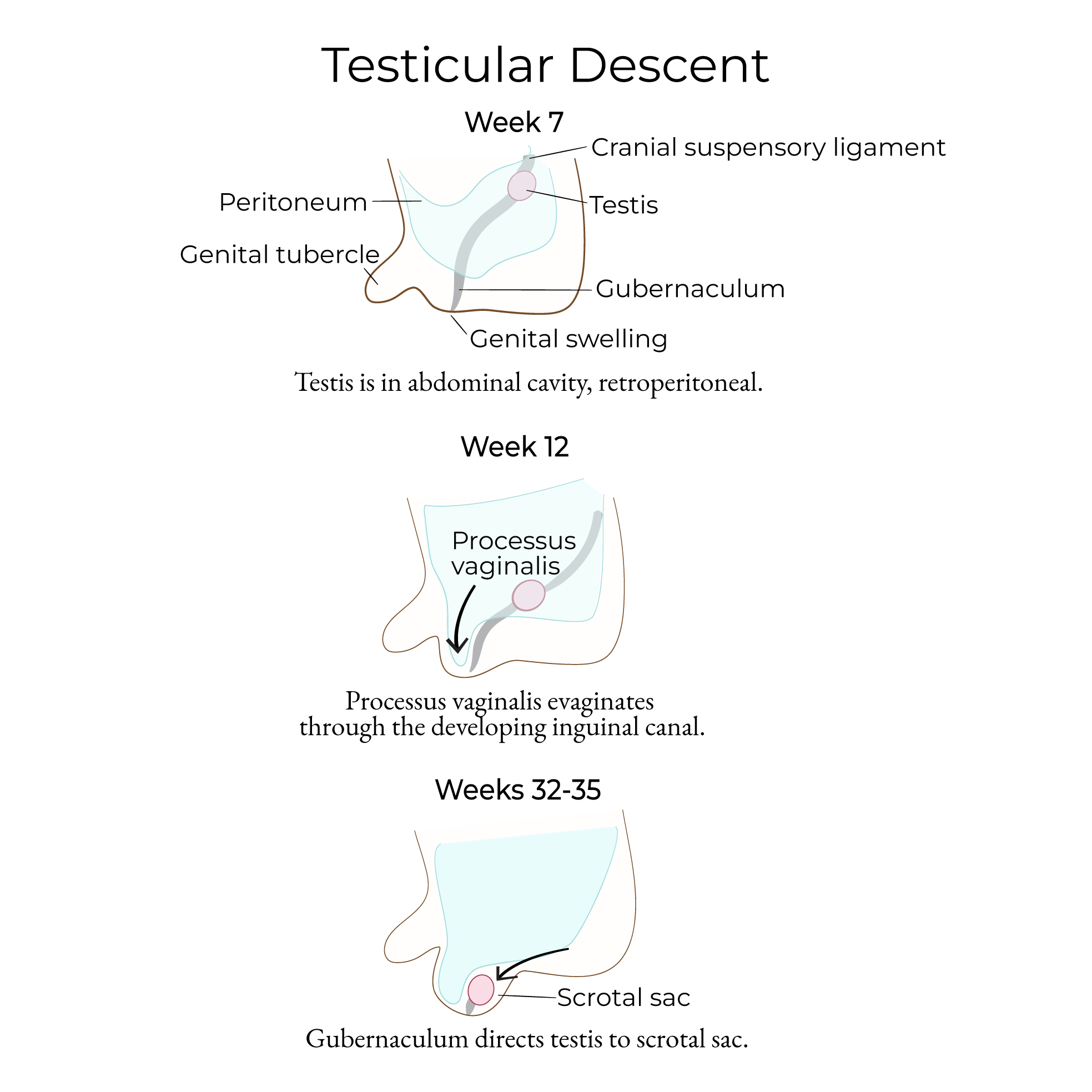 Descent of the Testes