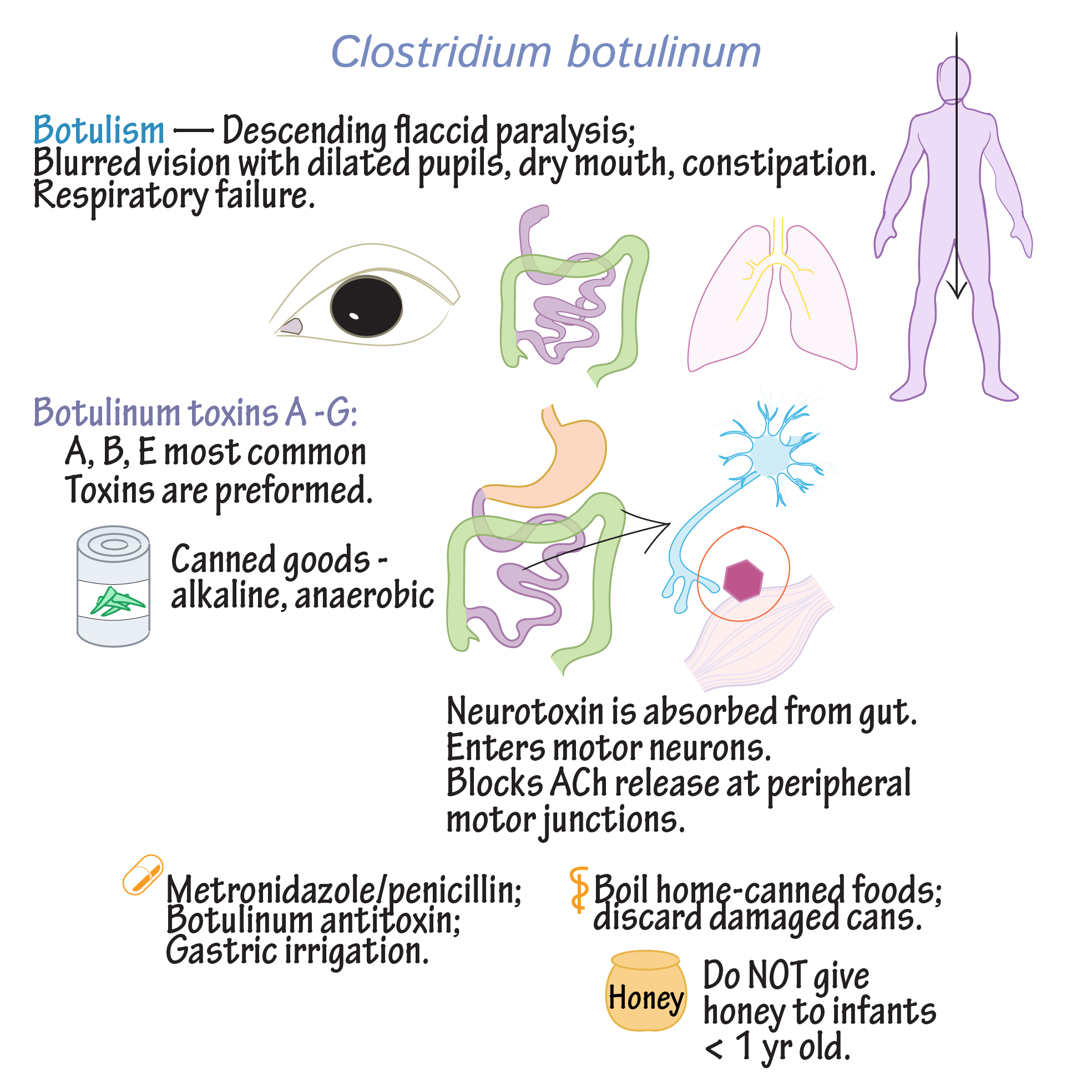 Botulism Symptoms Botulism Symptoms