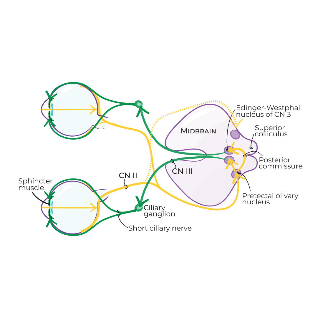 Parasympathetic Pupillary Light Reflex Pathway