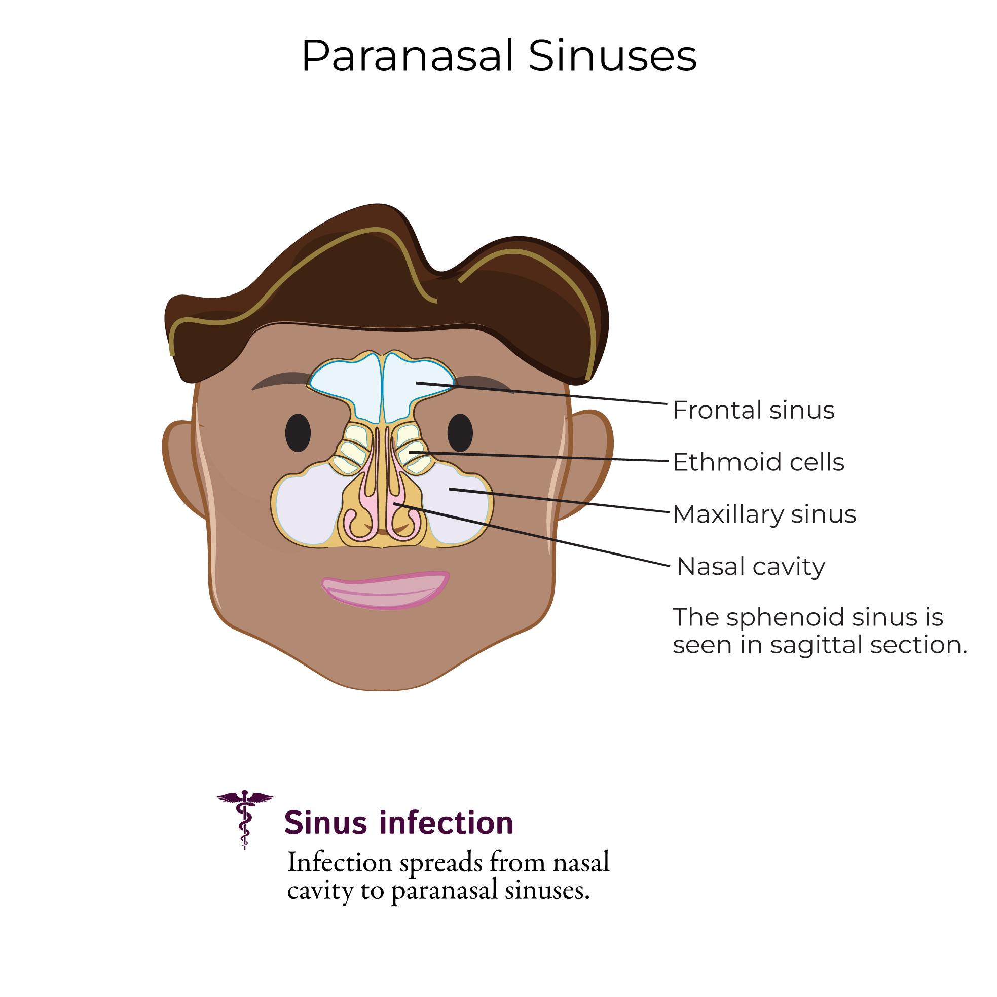 Paranasal Sinuses