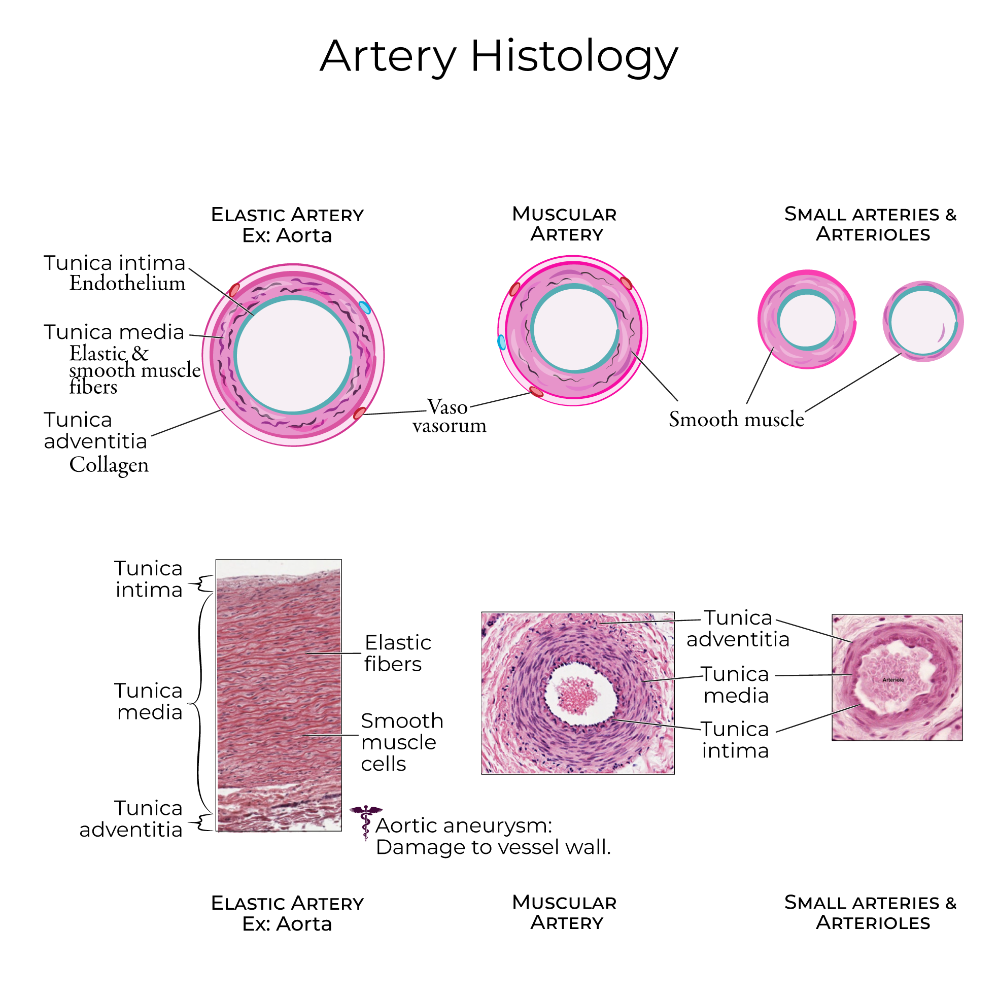 Histology Glossary Artery Histology Ditki Medical Biological Sciences Histology Glossary Artery Histology Ditki Medical Biological Sciences