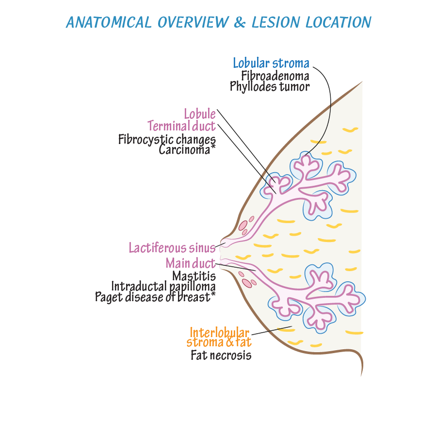 Benign Breast Diseases