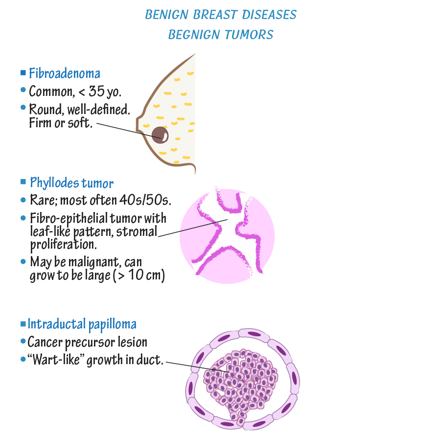 Benign Breast Diseases