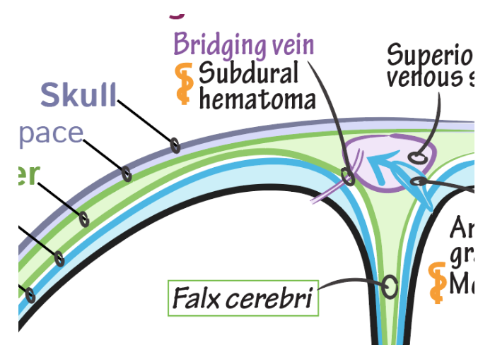 Neuroanatomy Glossary Bridging Vein Ditki Medical Biological Sciences Neuroanatomy Glossary Bridging Vein Ditki Medical Biological Sciences