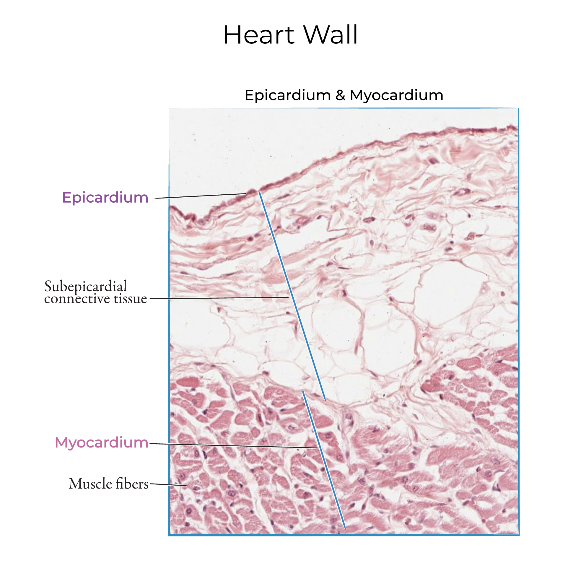 Heart Wall Histology