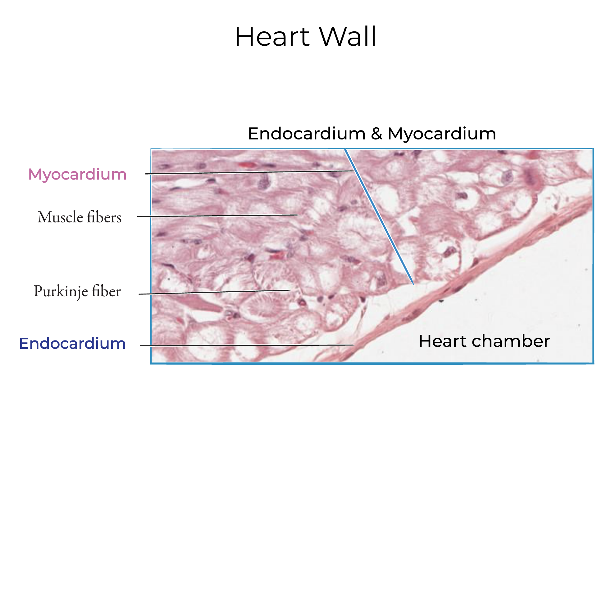 Heart Wall Histology