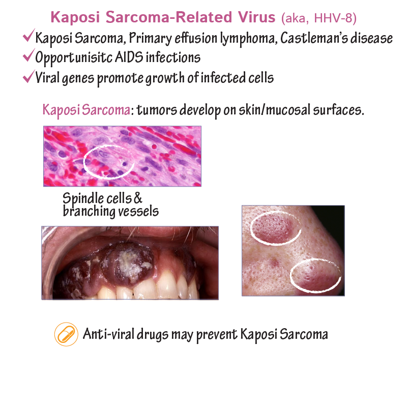 Human Herpes Virus 8: Kaposi Sarcoma-Related Virus