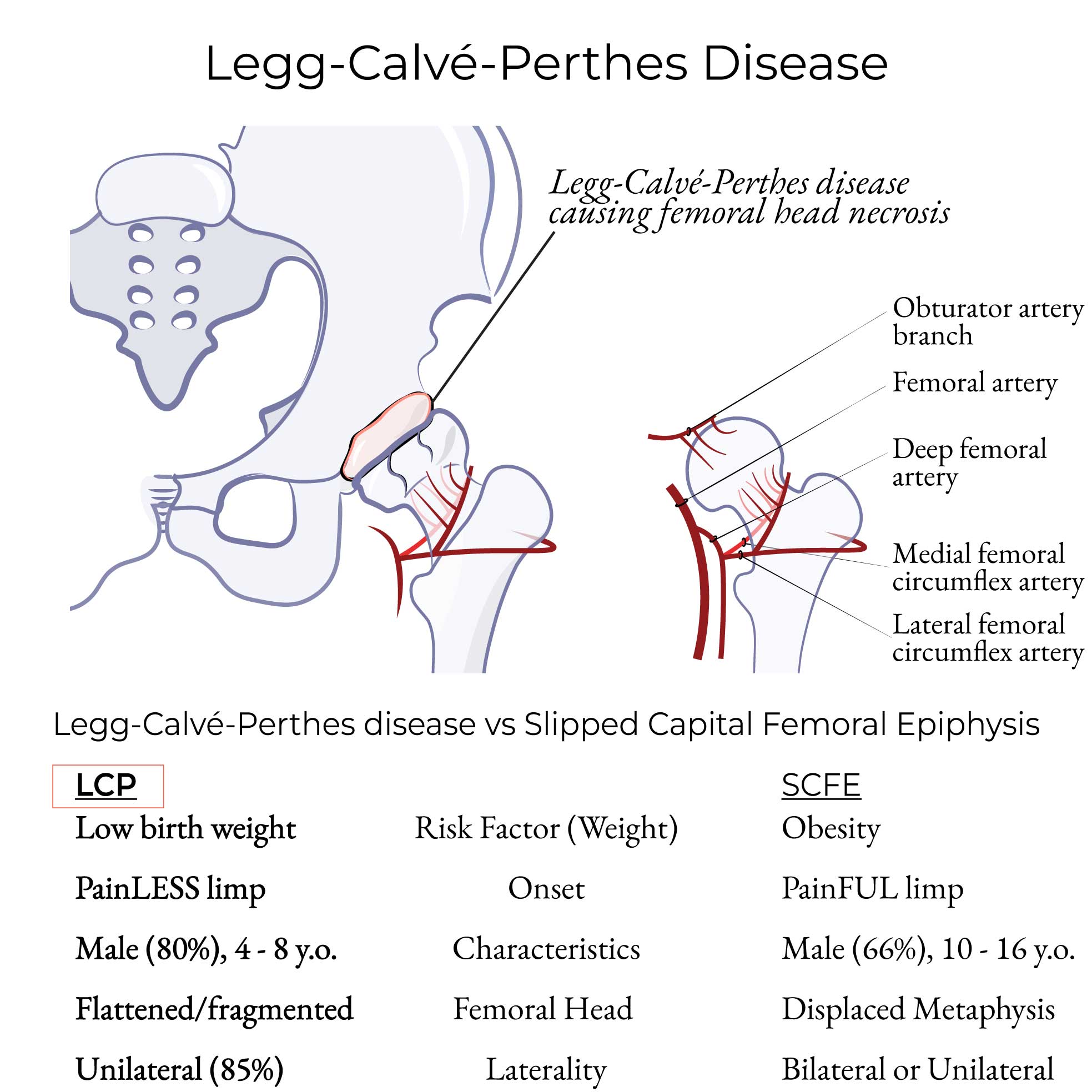 Legg-Calvé-Perthes Disease