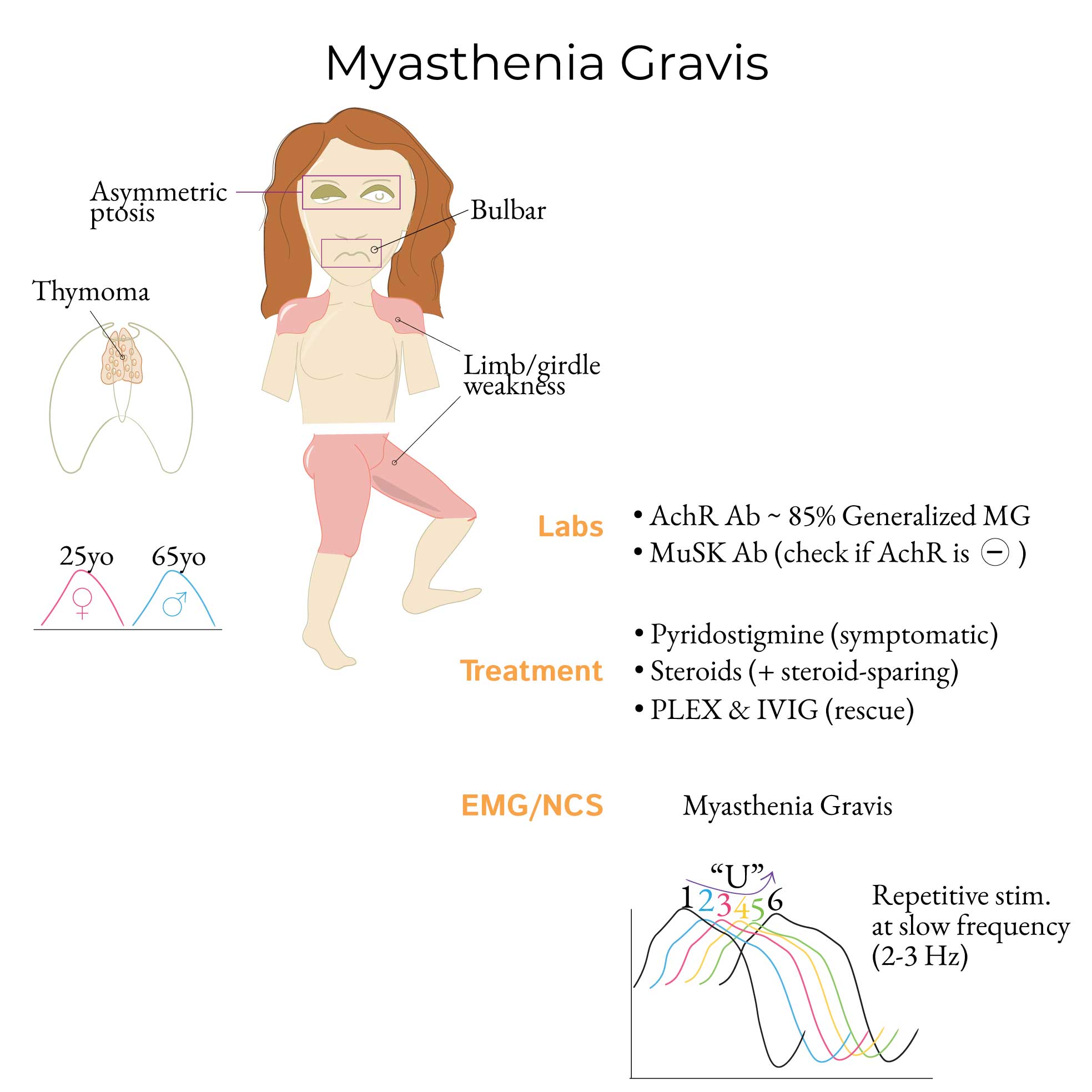 Myasthenia Gravis Ptosis Muscle Myasthenia Gravis Ptosis Muscle