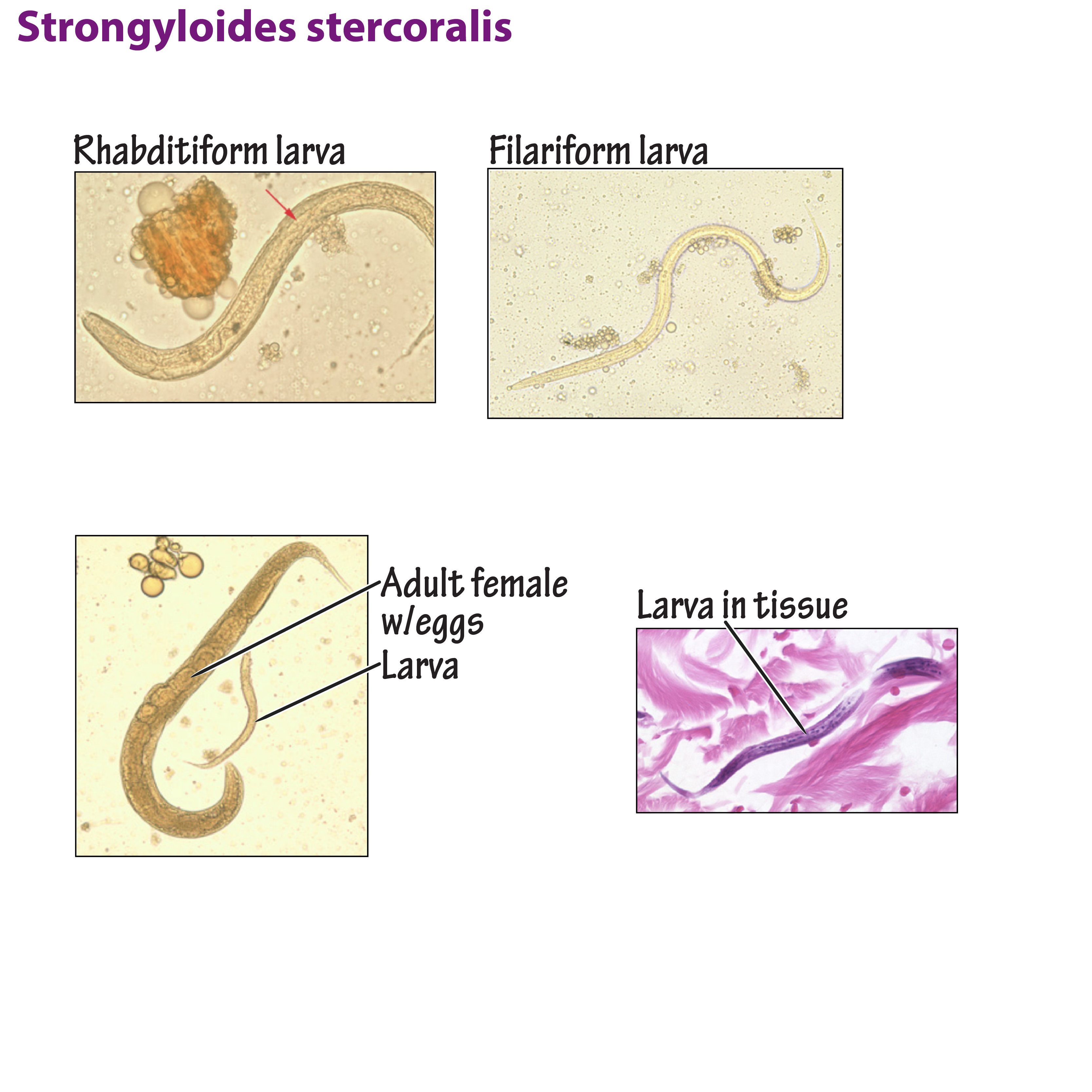 Strongyloides Stercoralis Life Cycle Strongyloides Stercoralis Life Cycle