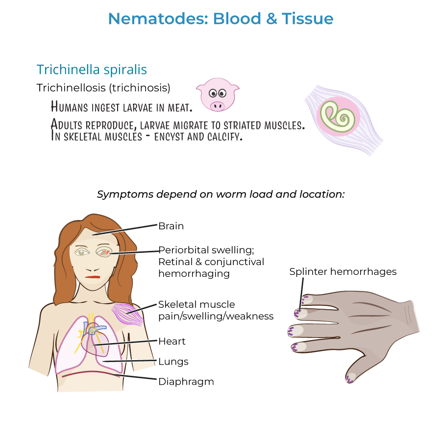Nematodes - Blood & Tissue Infections