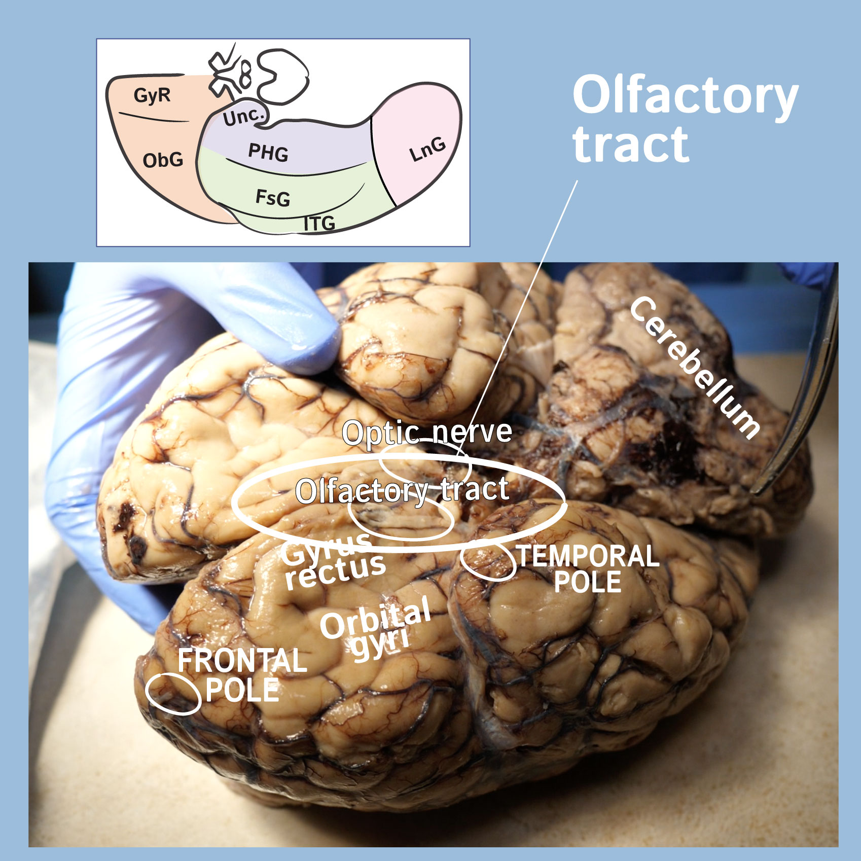 Olfactory Tract