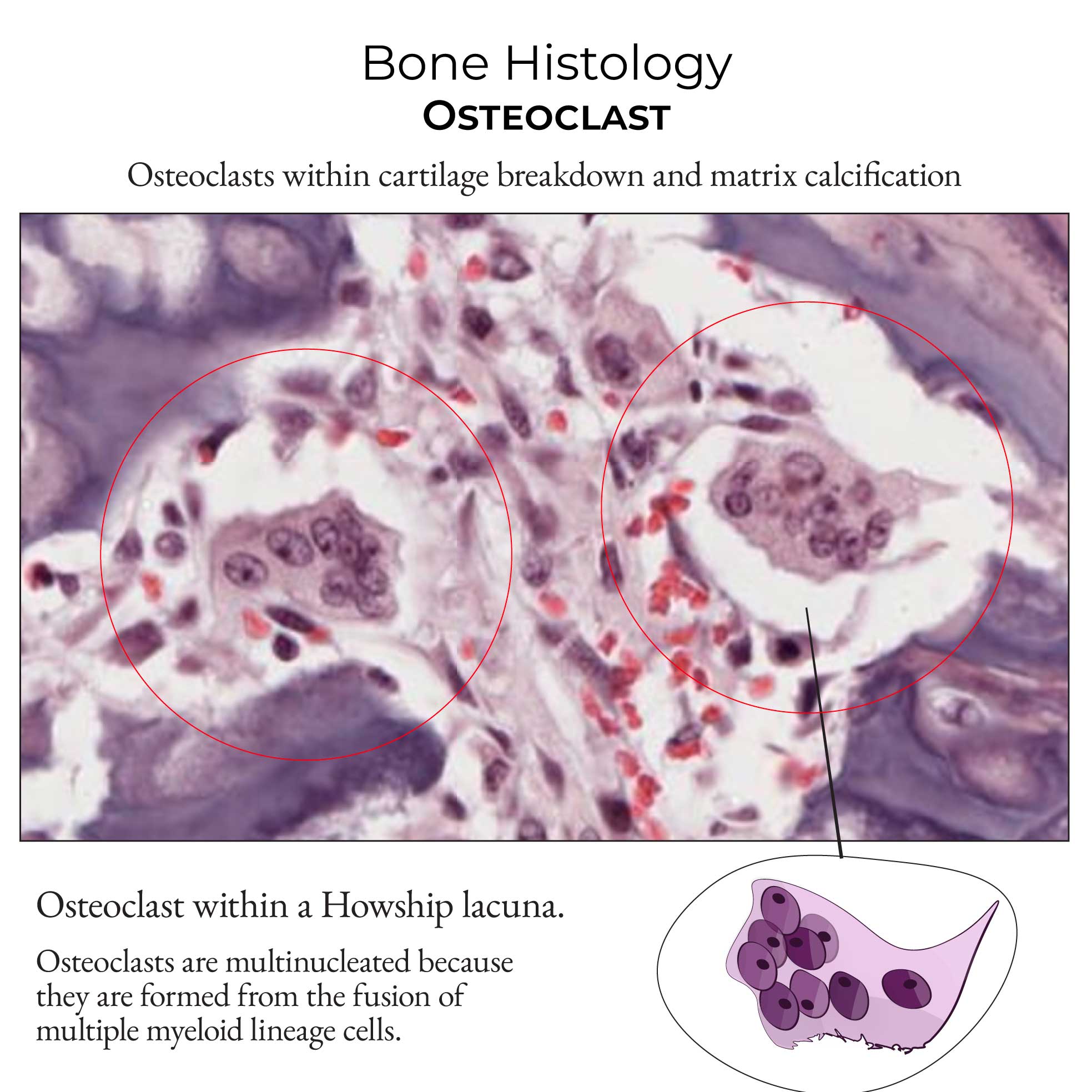 Osteoclast
