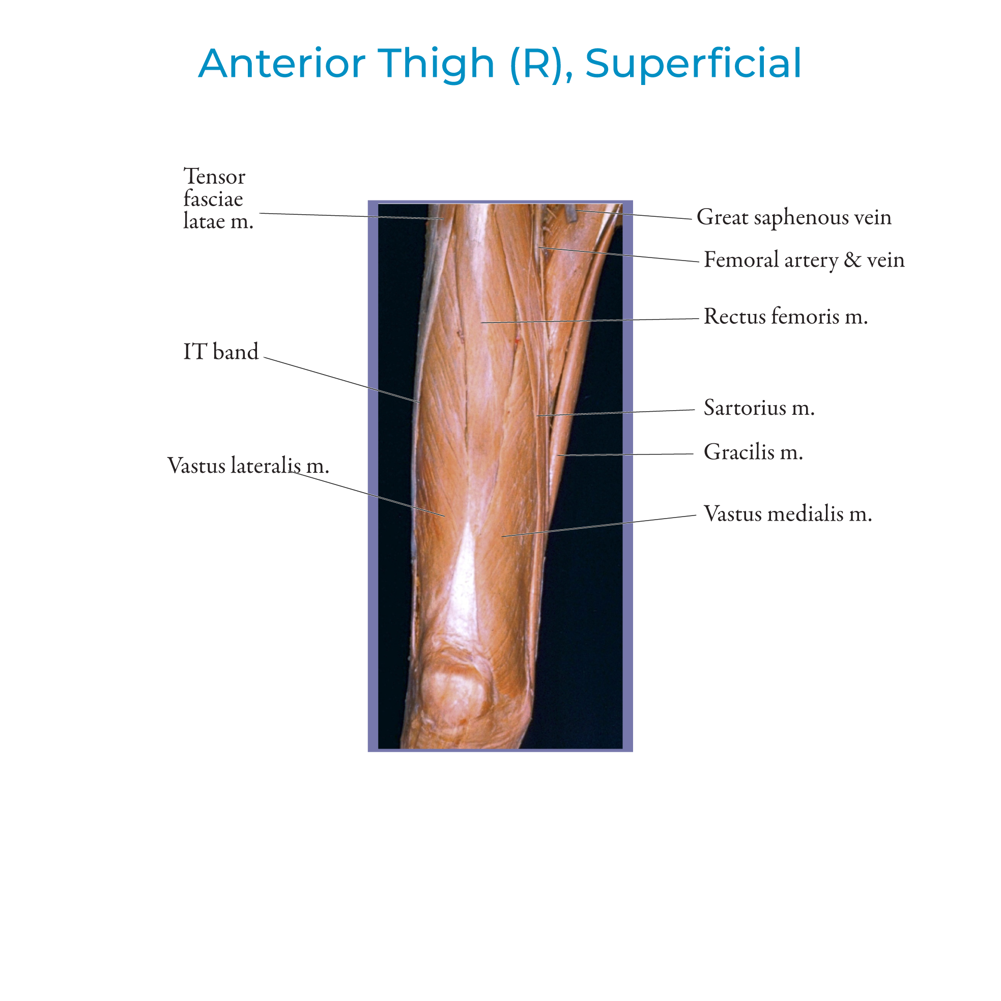 Anterior Thigh Muscles
