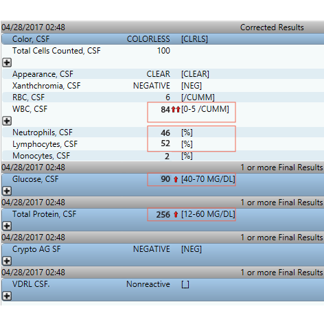 Rhombencephalitis (aka brainstem encephalitis)