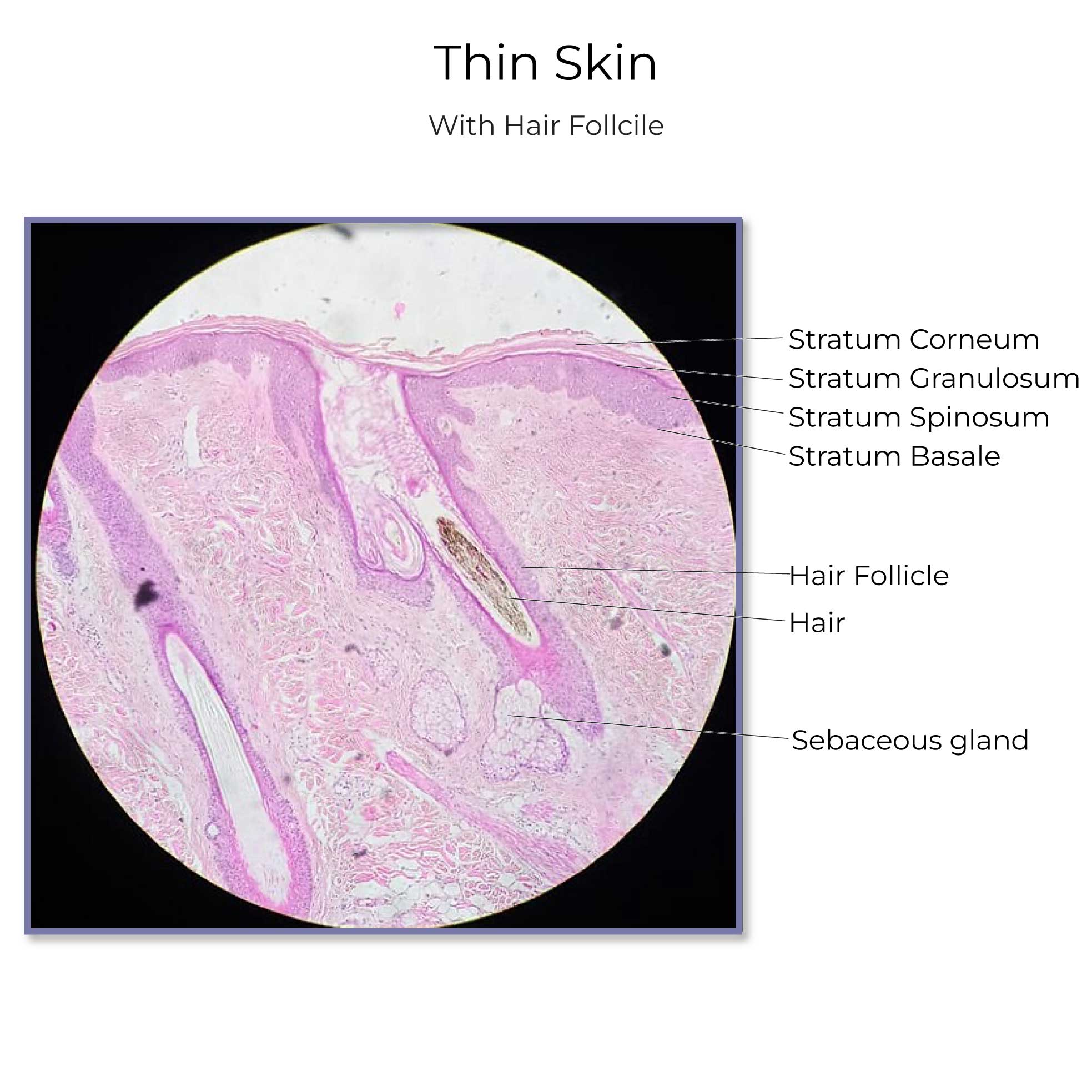 Integument (skin)