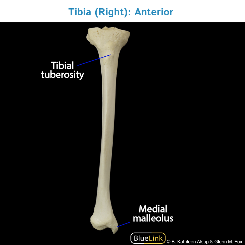 Tibial Tuberosity Attachment