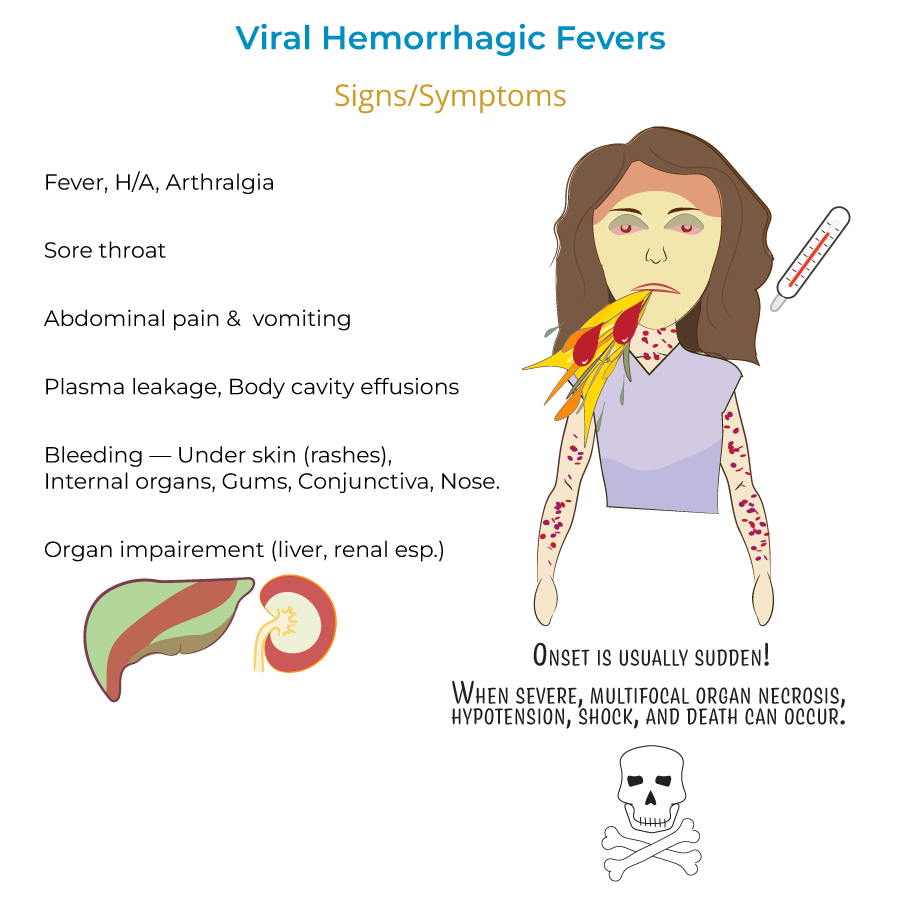 Immunology Microbiology Glossary Viral Hemorrhagic Fevers Ditki Immunology Microbiology Glossary Viral Hemorrhagic Fevers Ditki