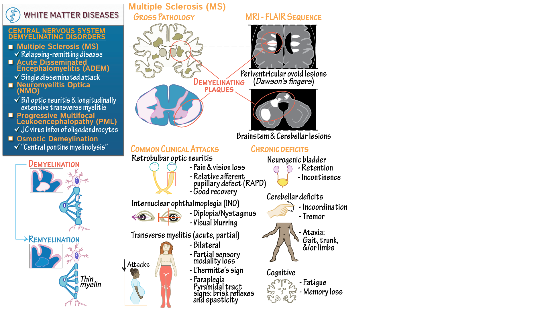 Pathology Multiple Sclerosis (MS) Draw It to Know It