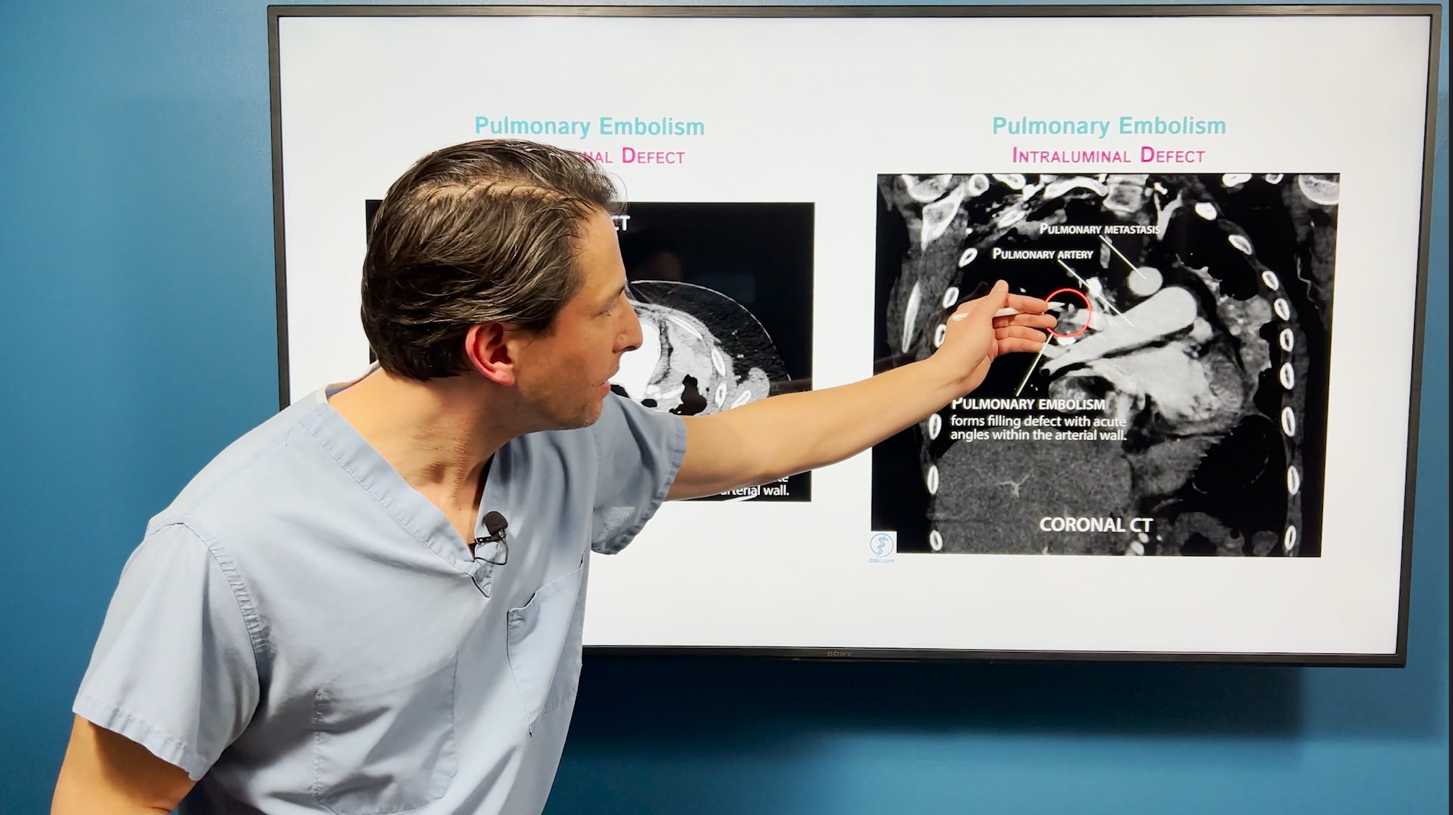 Neurological System Altered Mental Status (Delirium, Encephalopathy