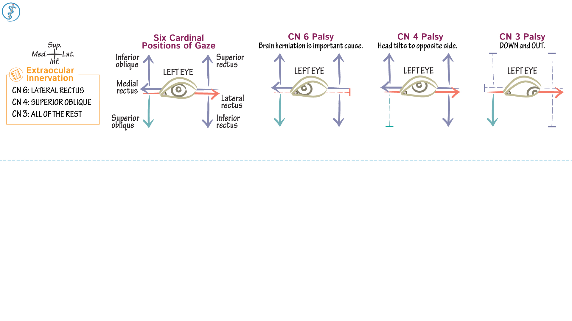Neuroanatomy Cardinal Positions & Extraocular Motor Palsies Draw It