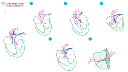 Embryology: Congenital Right to Left Shunts | ditki medical ...