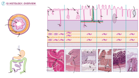Advanced Anatomy & Physiology: Overview of GI Histology | ditki medical ...
