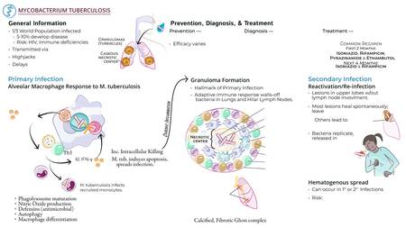USMLE / COMLEX - Step 1: Mycobacterium Tuberculosis Pathogenesis ...